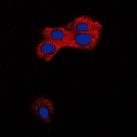 TGF beta 1 Rabbit Polyclonal Antibody