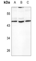 TGF beta 2 Rabbit Polyclonal Antibody