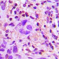 TGF beta 2 Rabbit Polyclonal Antibody