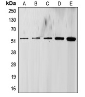 ALK5 Rabbit Polyclonal Antibody