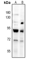 TGFBR2 Rabbit Polyclonal Antibody