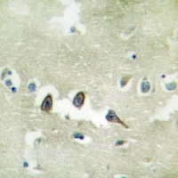 TGFBR2 Rabbit Polyclonal Antibody