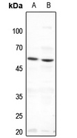 THRA Rabbit Polyclonal Antibody