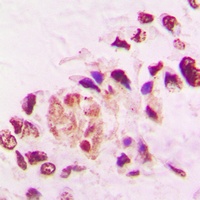 THRA Rabbit Polyclonal Antibody