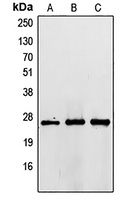 TIMP3 Rabbit Polyclonal Antibody