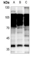 NKX2-1 Rabbit Polyclonal Antibody