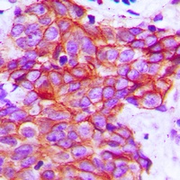 Claudin 5 Rabbit Polyclonal Antibody