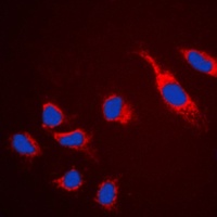 Claudin 5 Rabbit Polyclonal Antibody