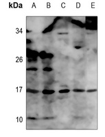 TNF alpha Rabbit Polyclonal Antibody