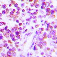 TNF alpha Rabbit Polyclonal Antibody