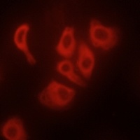 TNF alpha Rabbit Polyclonal Antibody