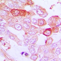 A20 Rabbit Polyclonal Antibody
