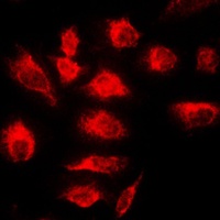 A20 Rabbit Polyclonal Antibody