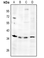 TSG6 Rabbit Polyclonal Antibody