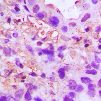TSG6 Rabbit Polyclonal Antibody