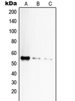 CD120a Rabbit Polyclonal Antibody