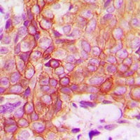 CD120a Rabbit Polyclonal Antibody
