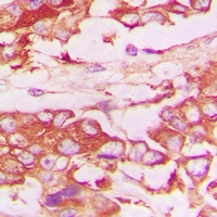 CD120b Rabbit Polyclonal Antibody