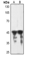 cTnT Rabbit Polyclonal Antibody