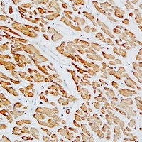 cTnT Rabbit Polyclonal Antibody