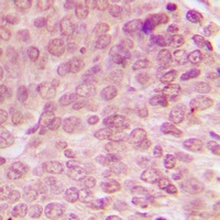 p53 (Phospho-S15) Rabbit Polyclonal Antibody
