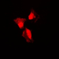 p53 (Phospho-S315) Rabbit Polyclonal Antibody