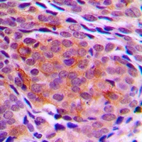 TCTP Rabbit Polyclonal Antibody