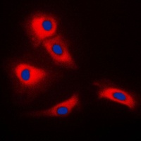 TRAF3 Rabbit Polyclonal Antibody