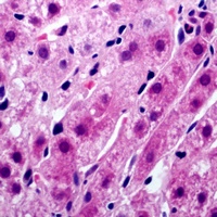 Tyrosinase Rabbit Polyclonal Antibody