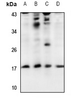 UBE2A/B Rabbit Polyclonal Antibody