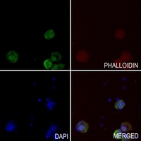 UBE2A/B Rabbit Polyclonal Antibody