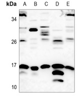 SUMO1 Rabbit Polyclonal Antibody