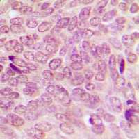 SUMO1 Rabbit Polyclonal Antibody