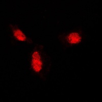 SUMO1 Rabbit Polyclonal Antibody
