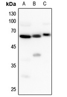 UGT8 Rabbit Polyclonal Antibody