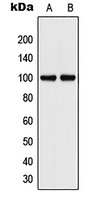 CD106 Rabbit Polyclonal Antibody