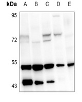 VDR Rabbit Polyclonal Antibody