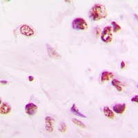VDR Rabbit Polyclonal Antibody