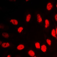 VDR Rabbit Polyclonal Antibody