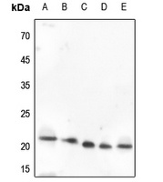 VEGFB Rabbit Polyclonal Antibody
