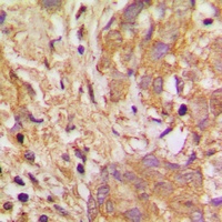 VEGFB Rabbit Polyclonal Antibody