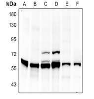 Vimentin Rabbit Polyclonal Antibody