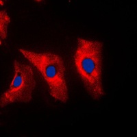 Vimentin Rabbit Polyclonal Antibody