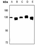 CLIP2 Rabbit Polyclonal Antibody