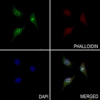 CLIP2 Rabbit Polyclonal Antibody