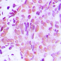 XRCC1 Rabbit Polyclonal Antibody