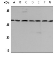 14-3-3 gamma Rabbit Polyclonal Antibody