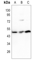 PAX8 Rabbit Polyclonal Antibody