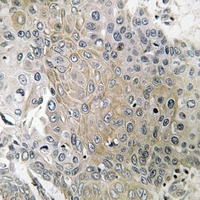 CD184 (Phospho-S339) Rabbit Polyclonal Antibody
