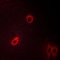 CD184 (Phospho-S339) Rabbit Polyclonal Antibody